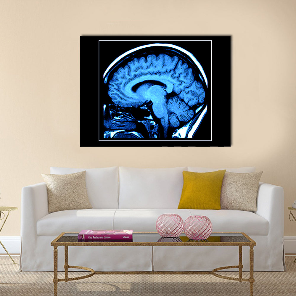 Mri Scan of the Human Brain Canvas Wall Art