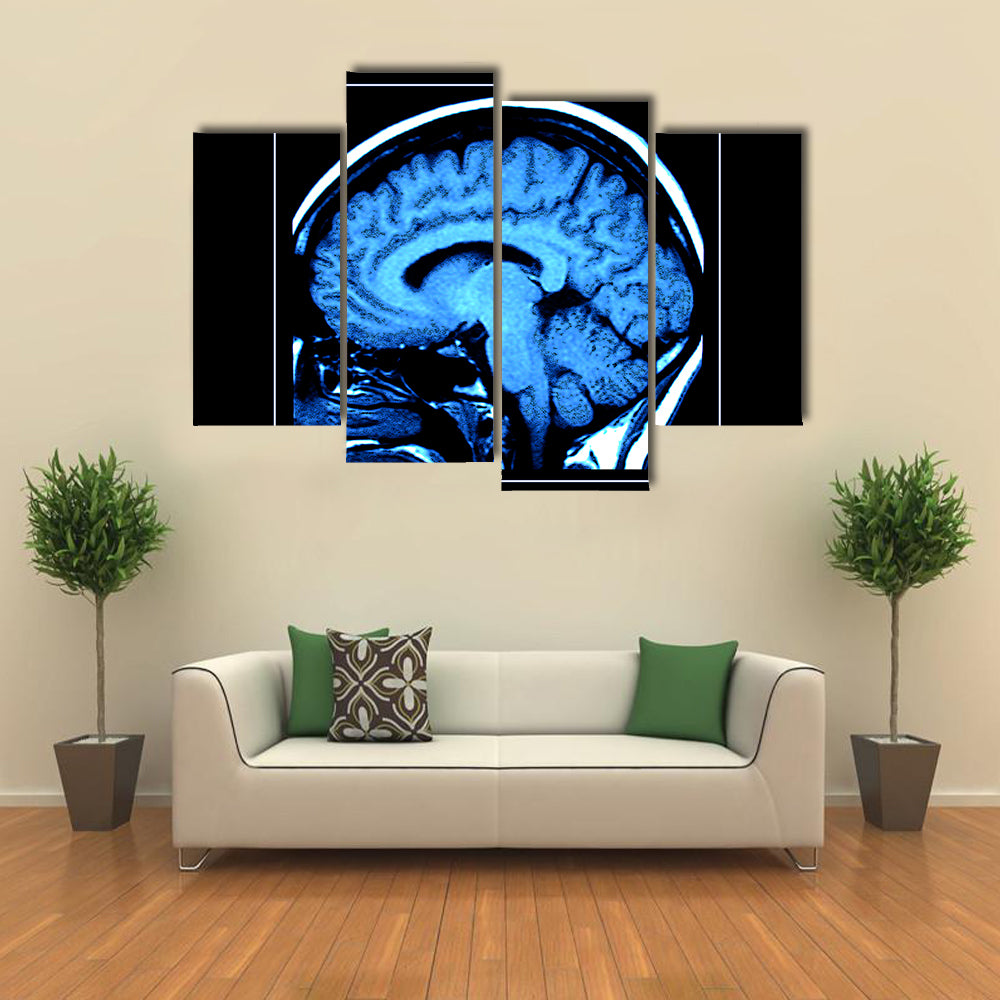 Mri Scan of the Human Brain Canvas Wall Art