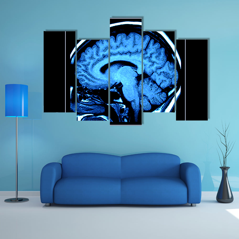 Mri Scan of the Human Brain Canvas Wall Art