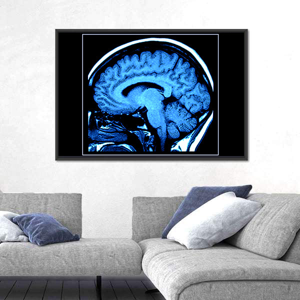 Mri Scan of the Human Brain Canvas Wall Art