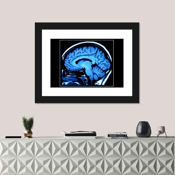 Mri Scan of the Human Brain Canvas Wall Art
