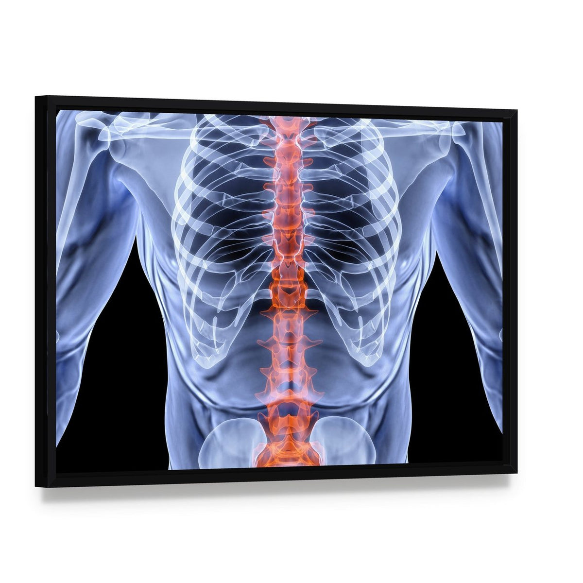 X-ray Male Spine with Glowing Red Vertebrae Canvas Wall Art, framed canvas in a black floater frame, angled product view