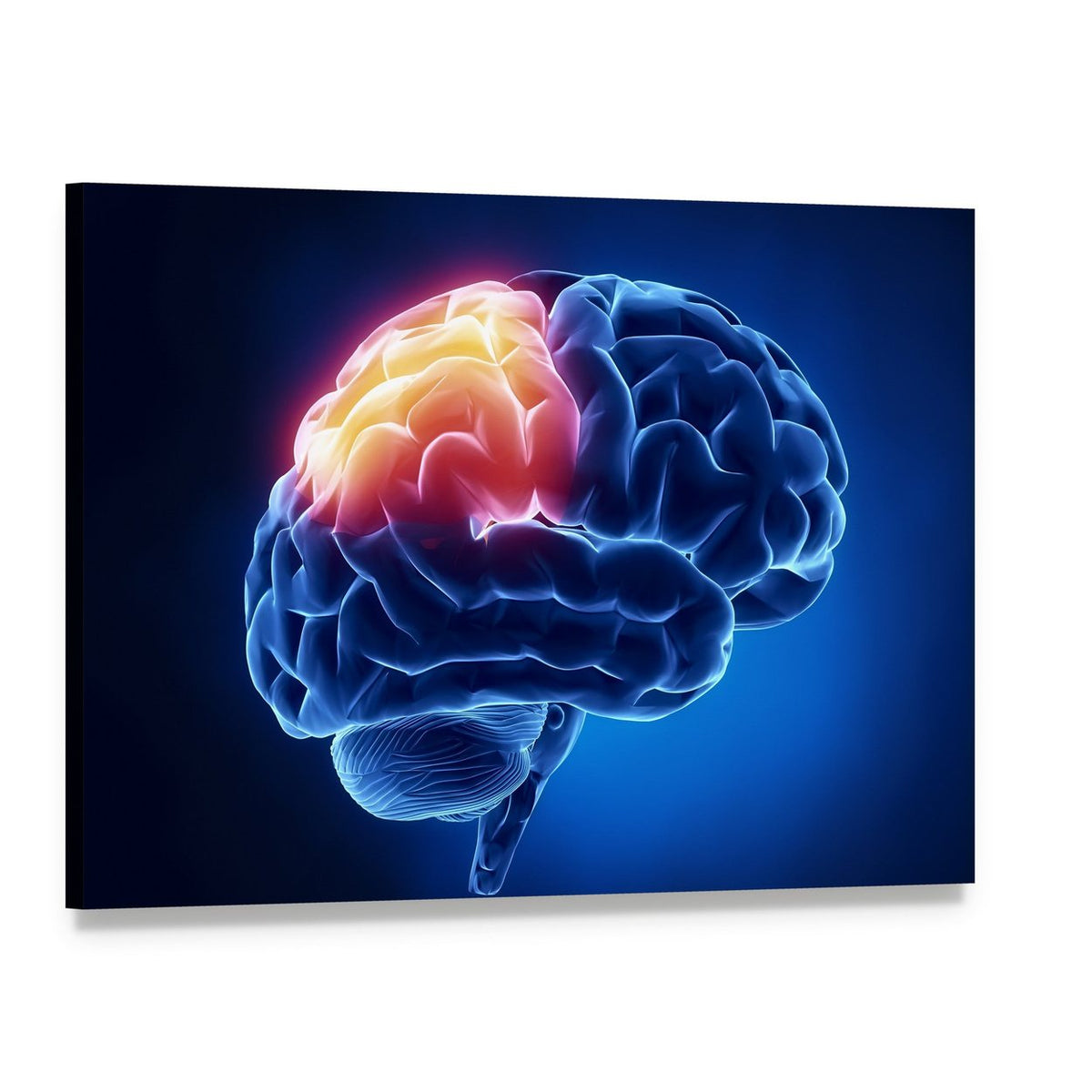 Human Brain X-ray Close-up Canvas Wall Art, single panel gallery wrapped canvas, angled product view