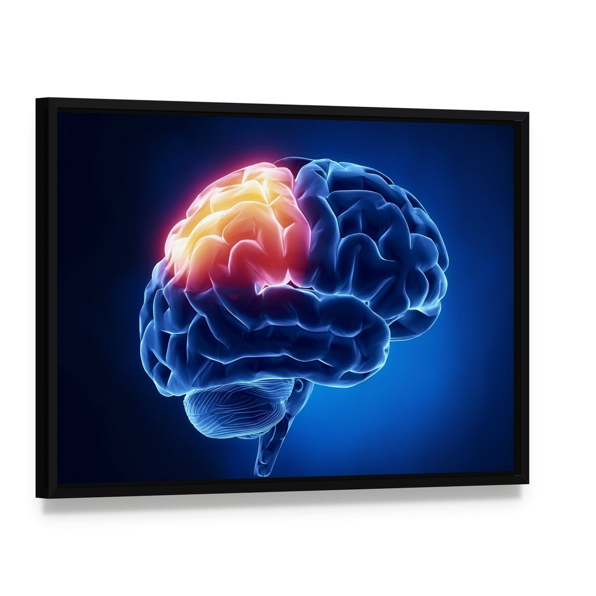 Human Brain X-ray Close-up Canvas Wall Art, framed canvas in a black floater frame, angled product view