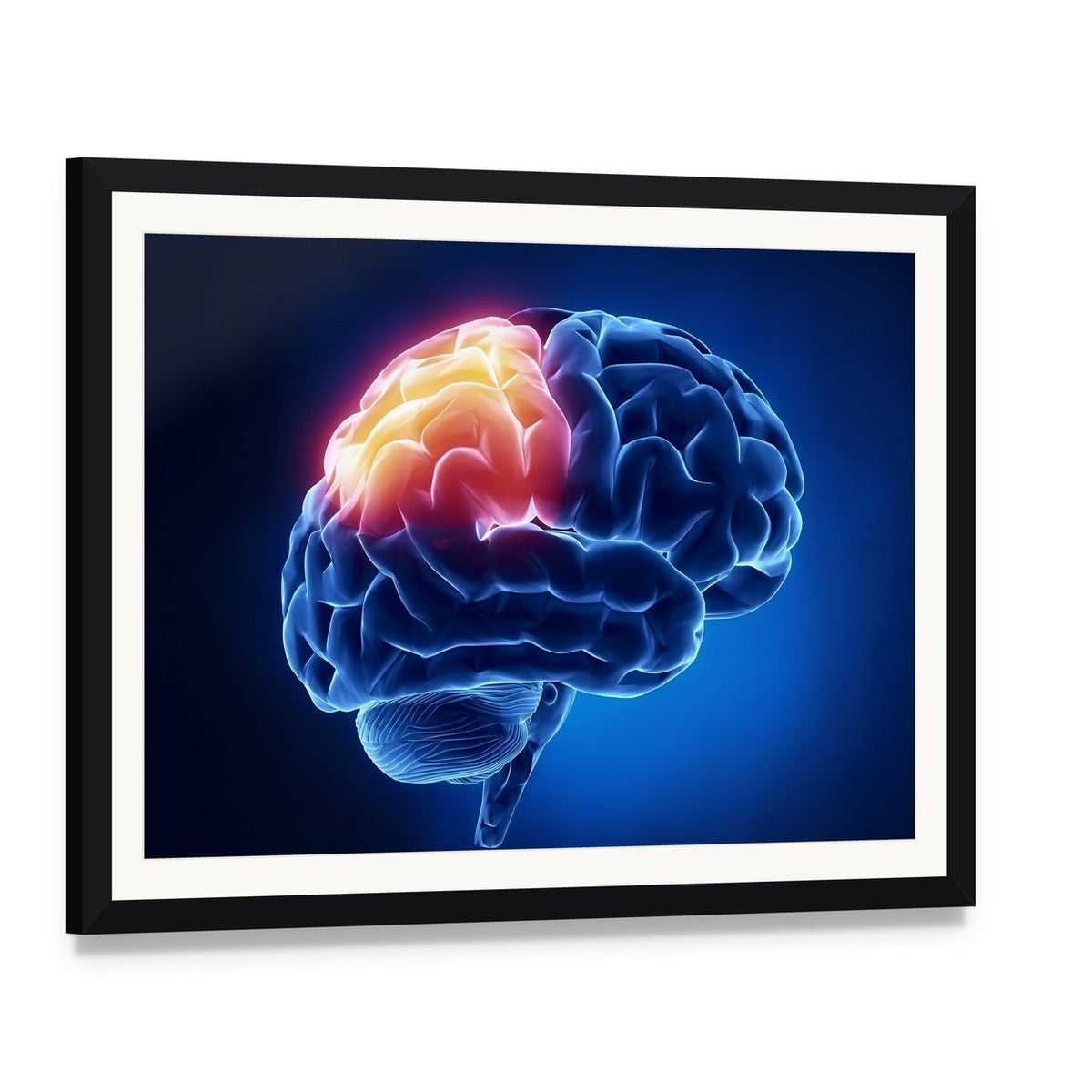 Human Brain X-ray Close-up Canvas Wall Art, framed print with white mat and black frame, angled product view