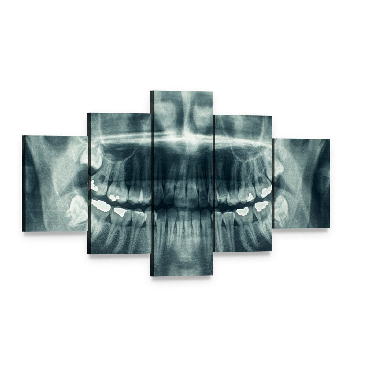 Dental X-ray Canvas Wall Art, 5 panel 5 Star layout gallery wrapped canvas set, angled product view