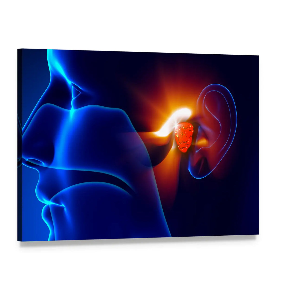 Inner Ear Pain Illustration Canvas Wall Art, single panel gallery wrapped canvas, angled product view