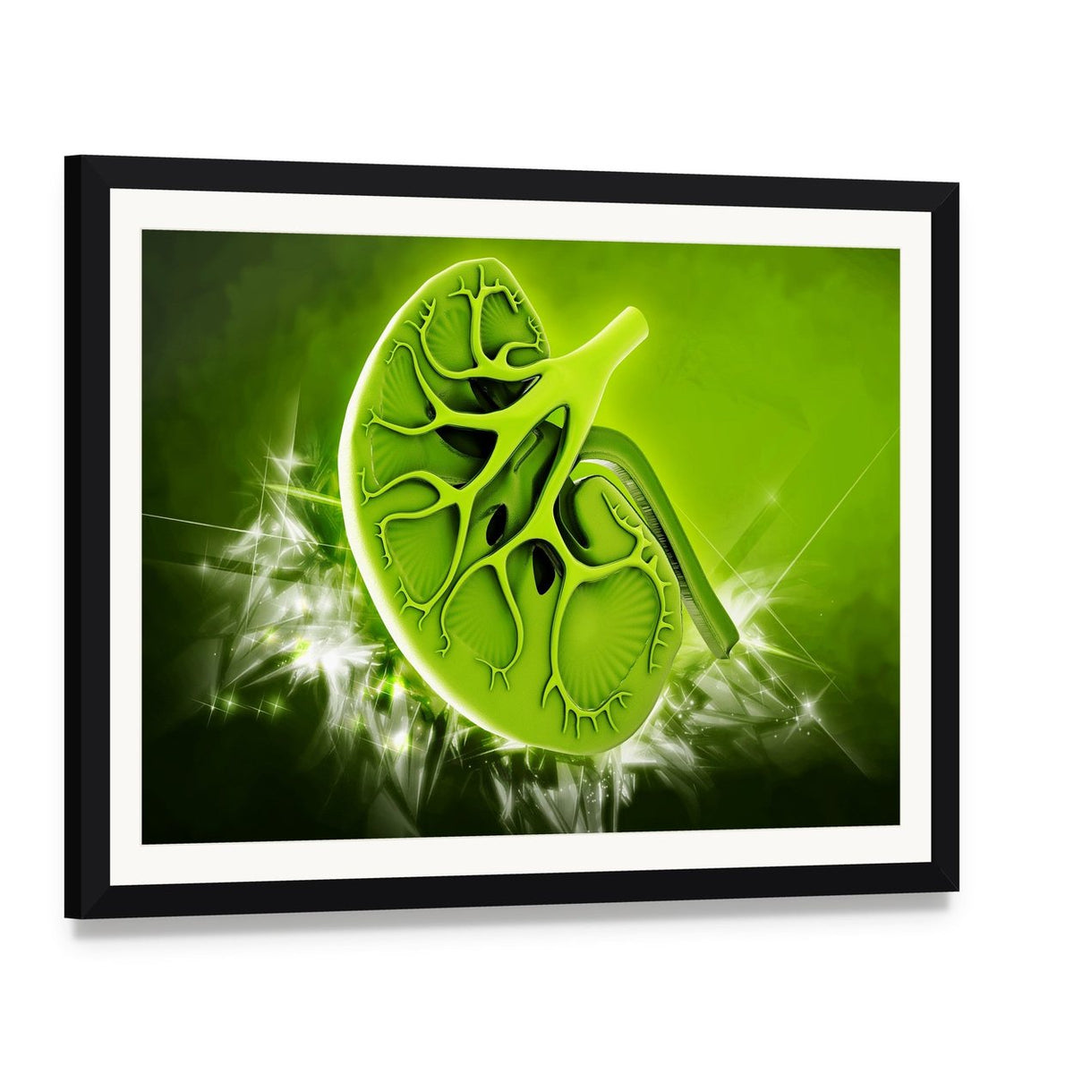 Human Kidney Cross-section Illustration Canvas Wall Art, framed print with white mat and black frame, angled product view