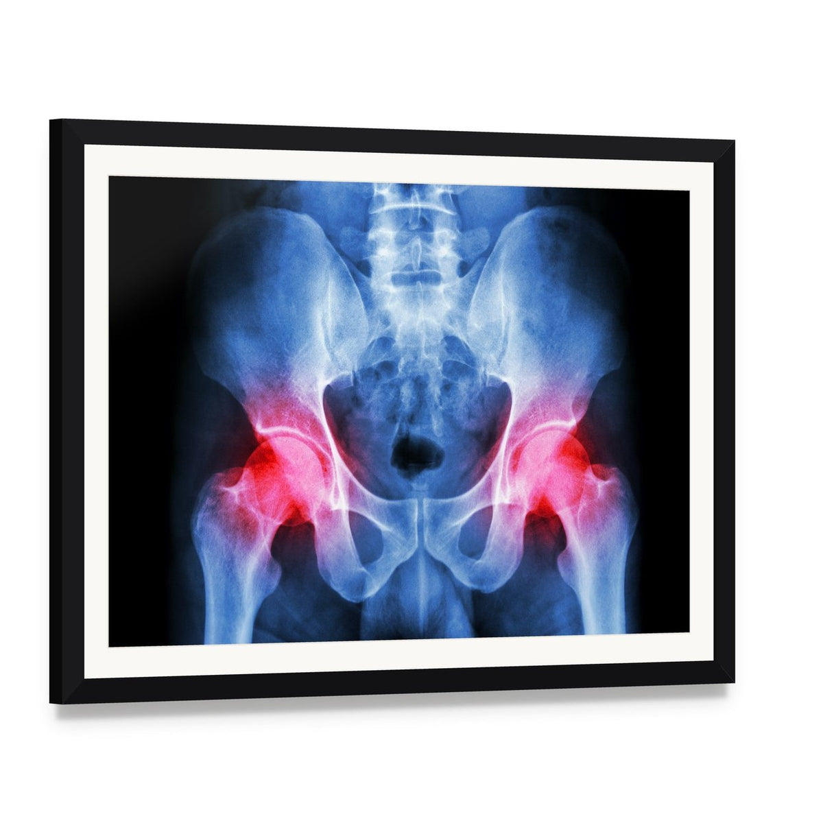 Pelvis X-ray Canvas Wall Art, framed print with white mat and black frame, angled product view