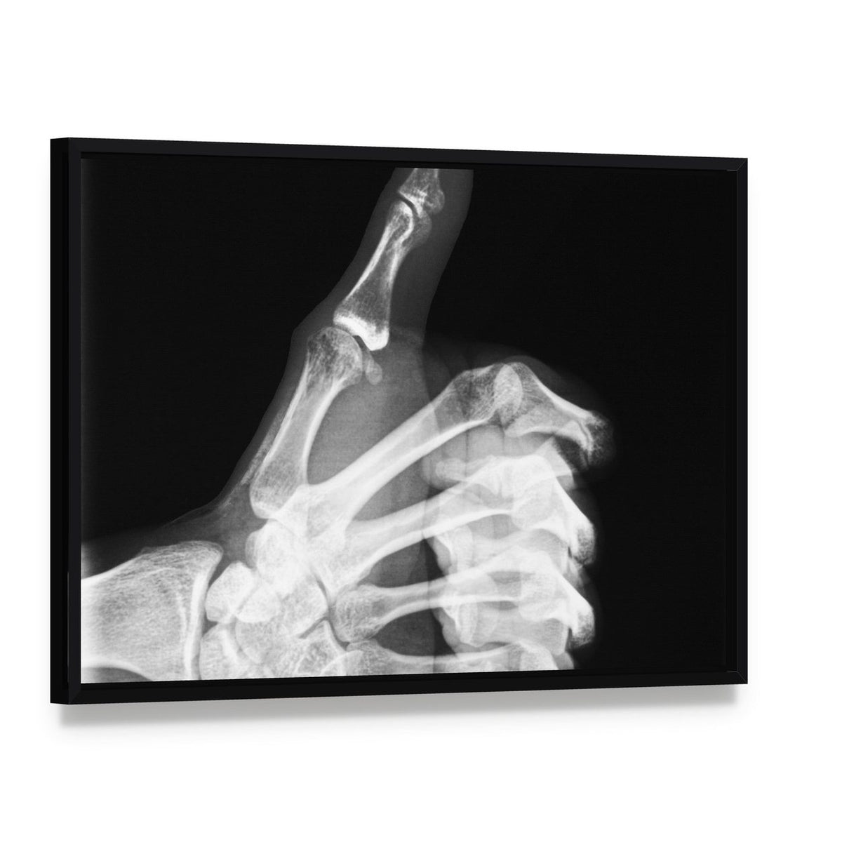 Thumb X-ray Study Canvas Wall Art, framed canvas in a black floater frame, angled product view