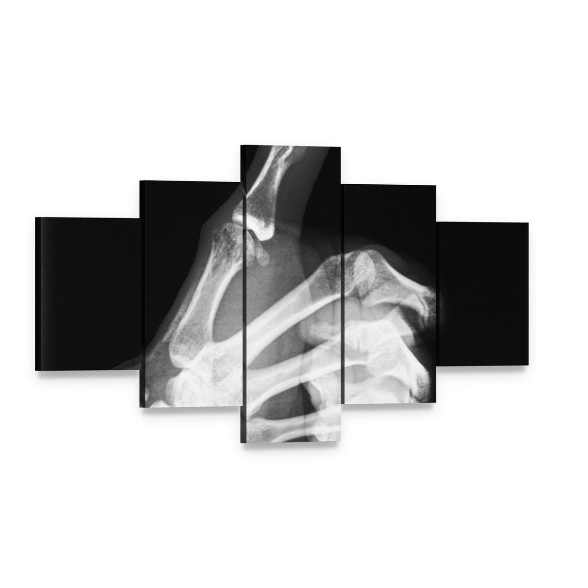Thumb X-ray Study Canvas Wall Art, 5 panel 5 Star layout gallery wrapped canvas set, angled product view