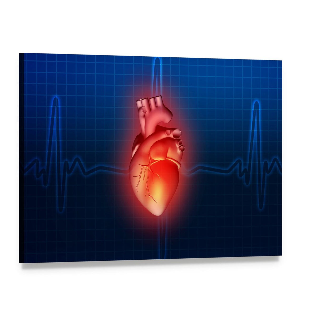 Glowing Anatomical Heart with Ecg Overlay Canvas Wall Art, single panel gallery wrapped canvas, angled product view