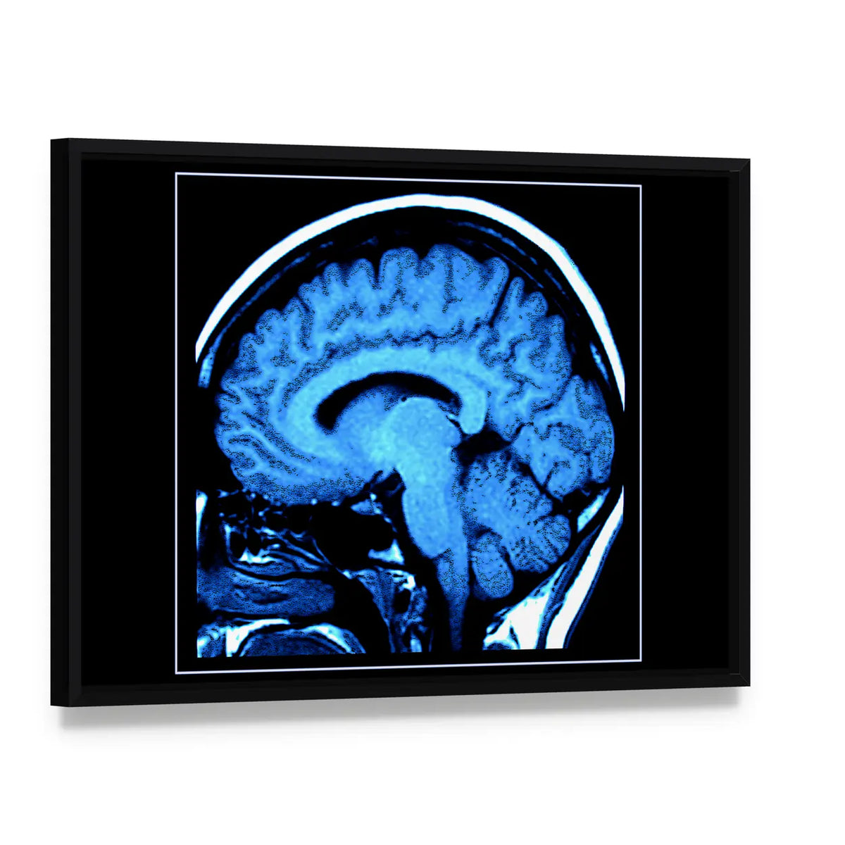 Mri Scan of the Human Brain Canvas Wall Art, framed canvas in a black floater frame, angled product view