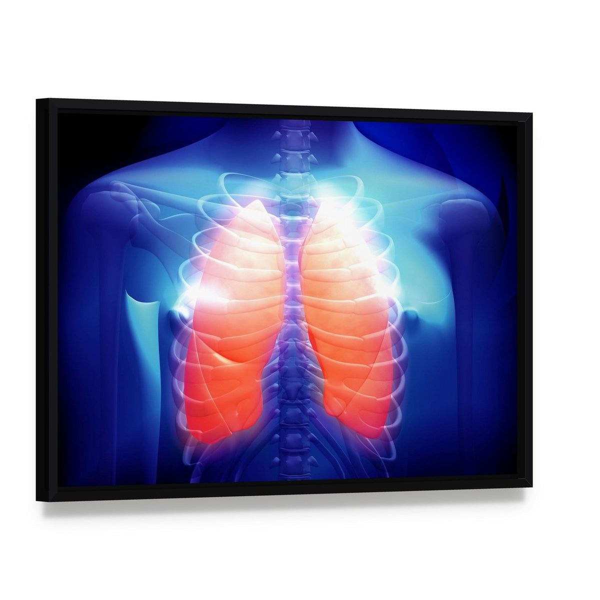 Human Lungs Anatomy Illustration Canvas Wall Art, framed canvas in a black floater frame, angled product view