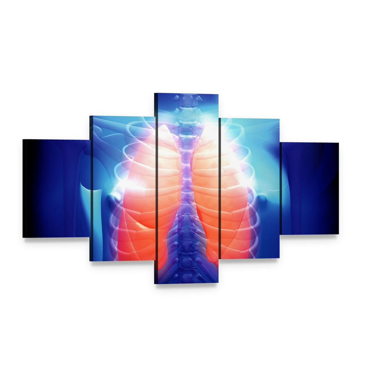 Human Lungs Anatomy Illustration Canvas Wall Art, 5 panel 5 Star layout gallery wrapped canvas set, angled product view