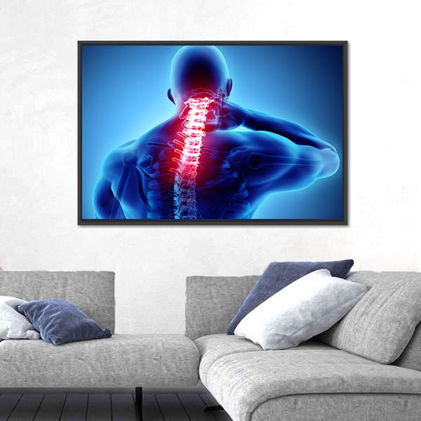 Painful Neck With Cervical Spine Skeleton X-Ray Canvas Wall Art-5 Horizontal-Gallery Wrap-22" x 12"-Tiaracle