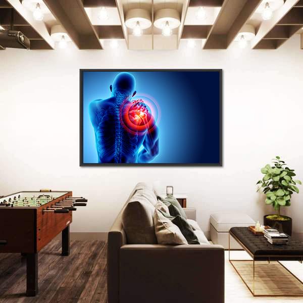 Shoulder Painful Skeleton X-Ray Canvas Wall Art-1 Piece-Floating Frame-24" x 16"-Tiaracle