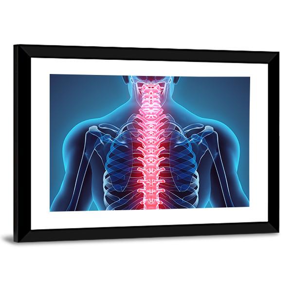 Spine Illustration Canvas Wall Art-5 Horizontal-Gallery Wrap-22" x 12"-Tiaracle