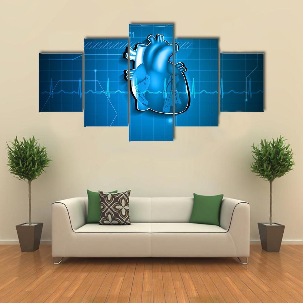 Abstract Of Cardiology Canvas Wall Art-5 Star-Gallery Wrap-62" x 32"-Tiaracle