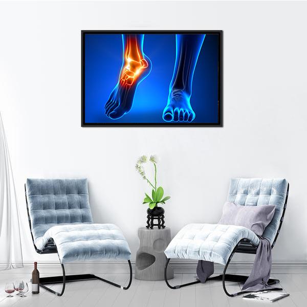 Ankle Pain Detail Canvas Wall Art-3 Horizontal-Gallery Wrap-25" x 16"-Tiaracle