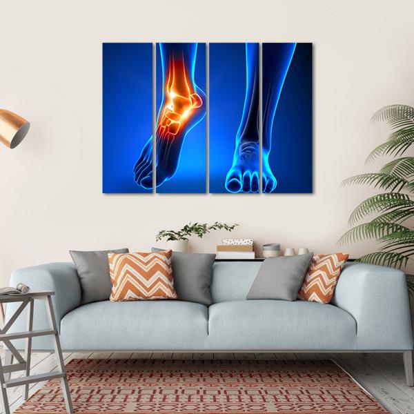 Ankle Pain Detail Canvas Wall Art-4 Horizontal-Gallery Wrap-34" x 24"-Tiaracle