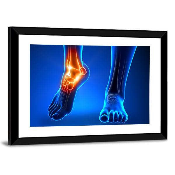 Ankle Pain Detail Canvas Wall Art-5 Horizontal-Gallery Wrap-22" x 12"-Tiaracle