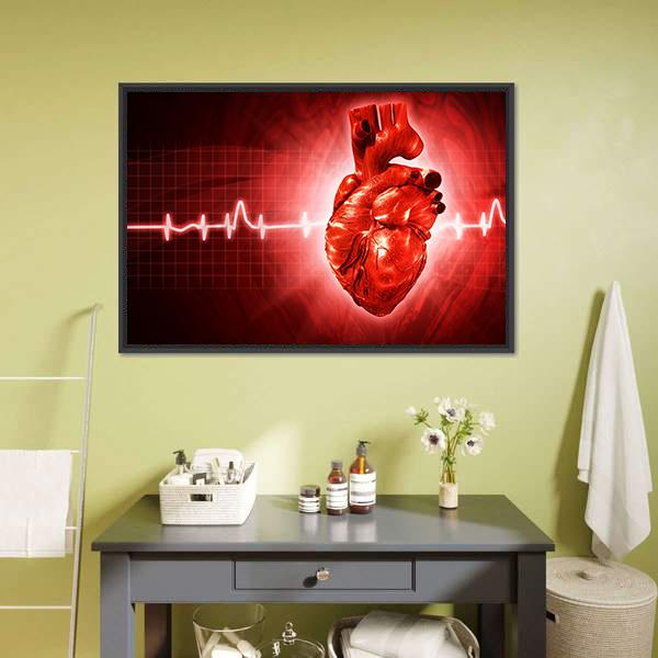 ECG Of Human Heart Canvas Wall Art-5 Horizontal-Gallery Wrap-22" x 12"-Tiaracle