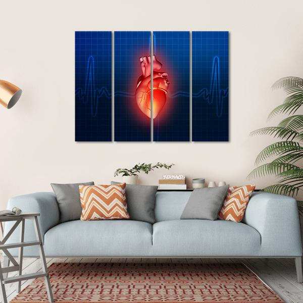 Heart Disease Illustration Canvas Wall Art-4 Horizontal-Gallery Wrap-34" x 24"-Tiaracle