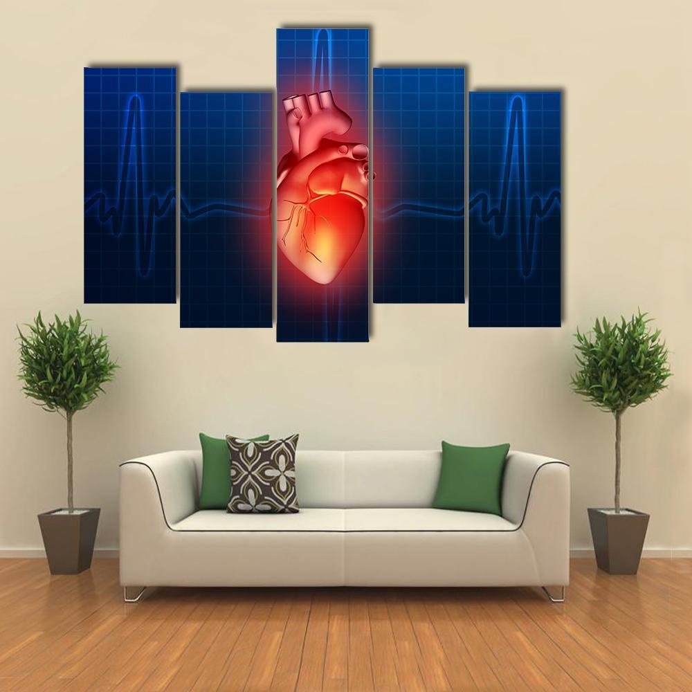 Heart Disease Illustration Canvas Wall Art-5 Pop-Gallery Wrap-47" x 32"-Tiaracle