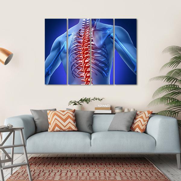 Human Backache & Back Pain Canvas Wall Art-4 Horizontal-Gallery Wrap-34" x 24"-Tiaracle