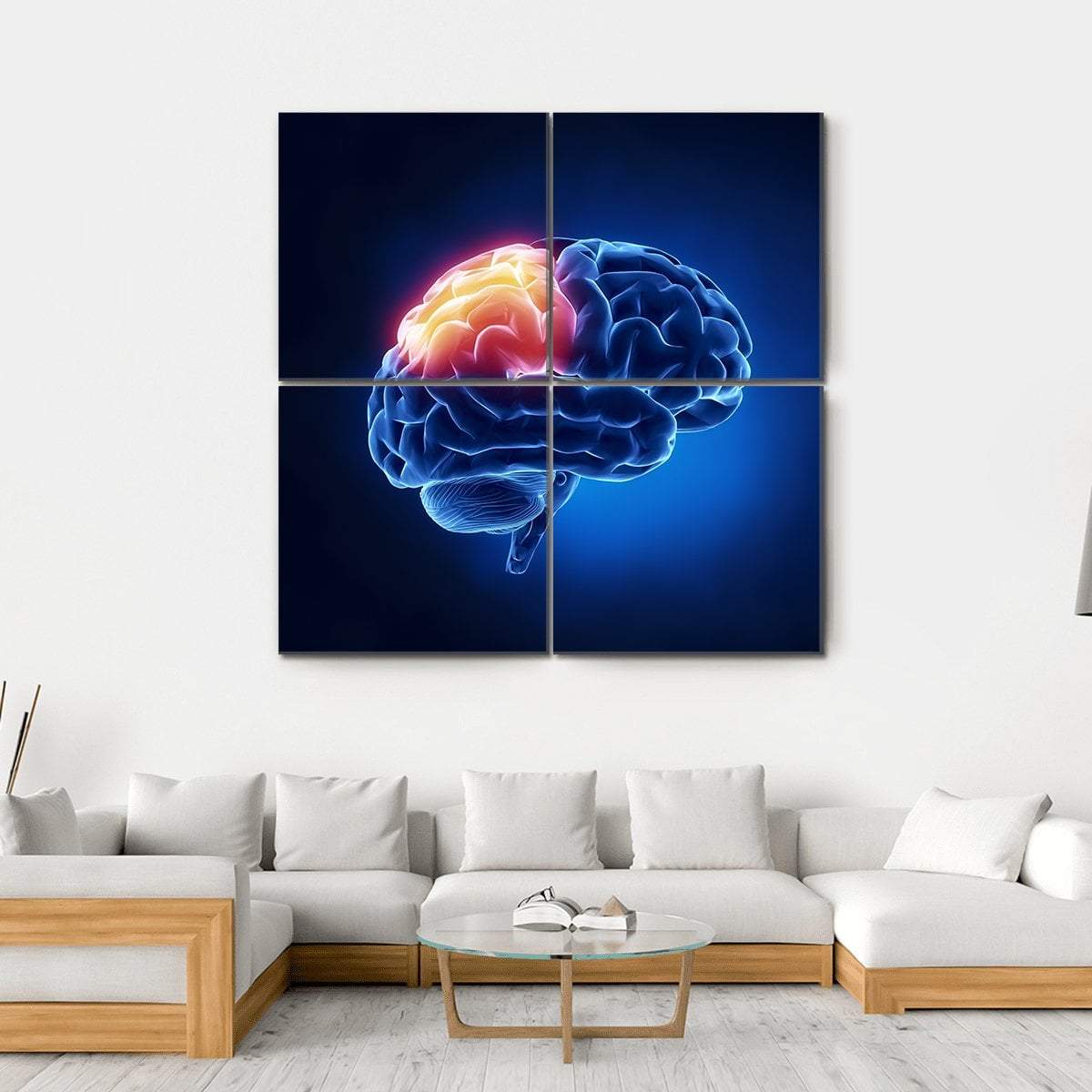 Human Brain X-Ray Canvas Wall Art-4 Square-Gallery Wrap-17" x 17"-Tiaracle