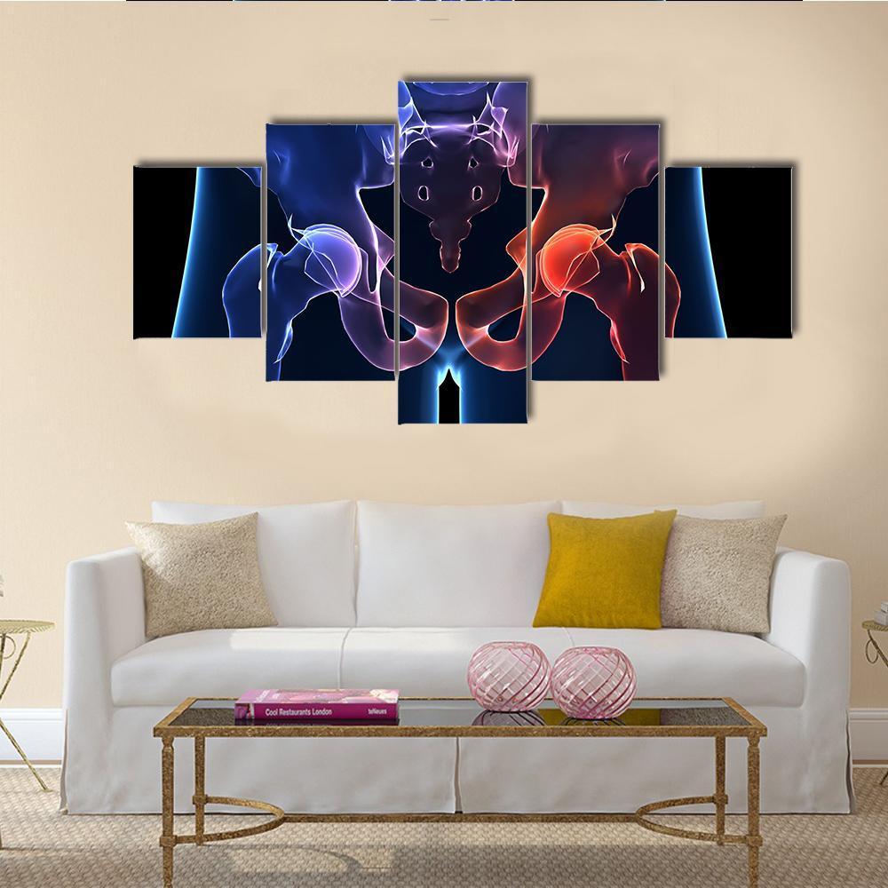 Human Painful Hip Canvas Wall Art-5 Star-Gallery Wrap-62" x 32"-Tiaracle