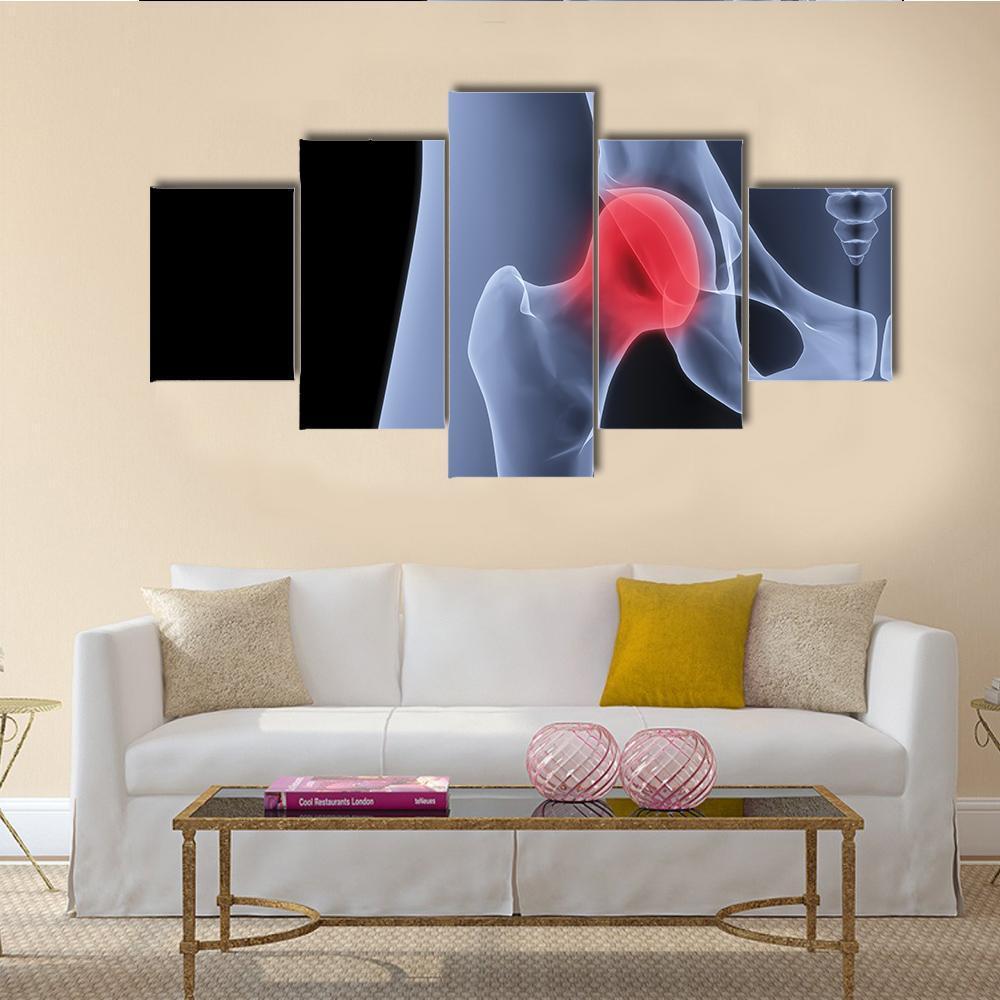 X-Rays Of Pelvis Canvas Wall Art-5 Star-Gallery Wrap-62" x 32"-Tiaracle