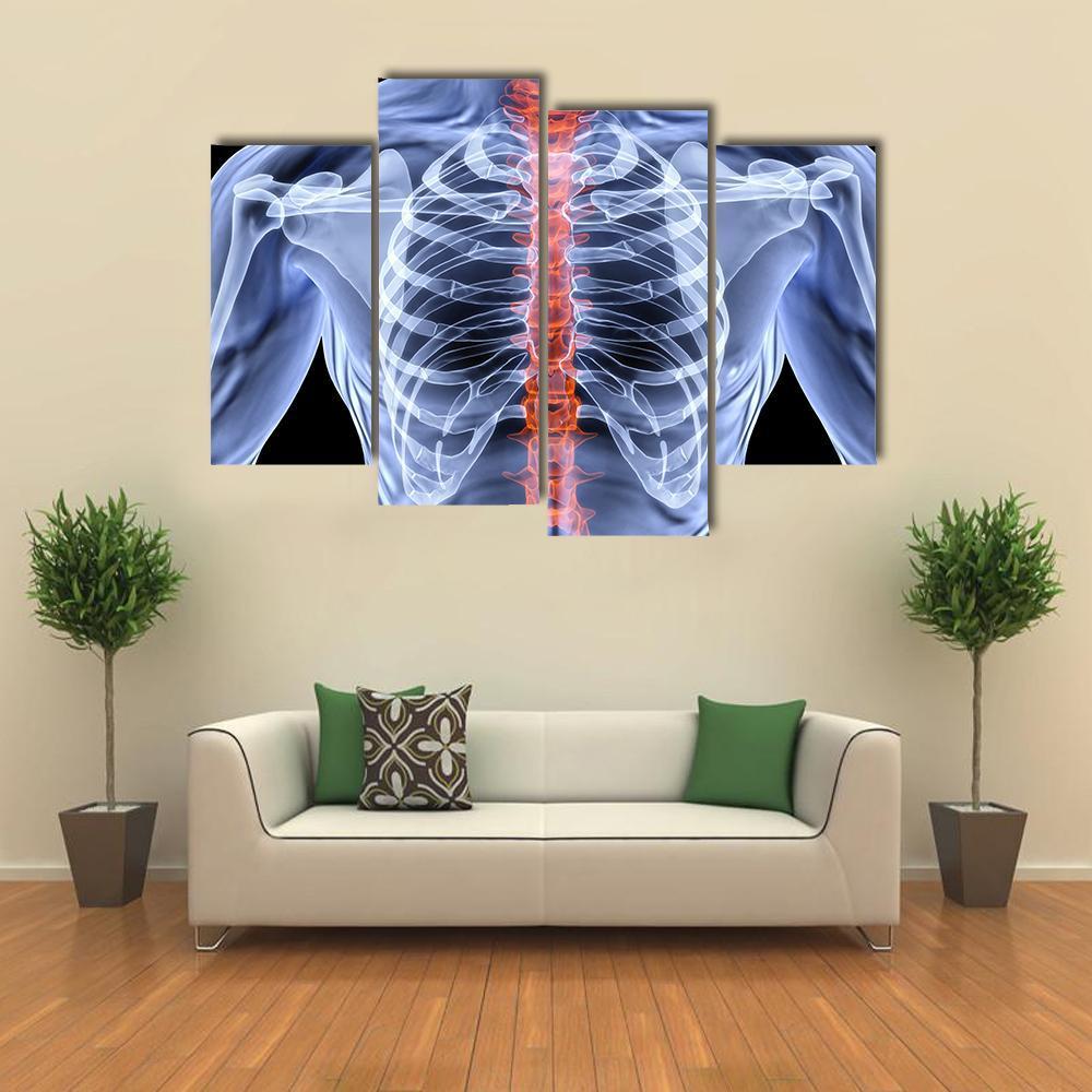 X-Ray Of Men Torso Canvas Wall Art-4 Pop-Gallery Wrap-50" x 32"-Tiaracle