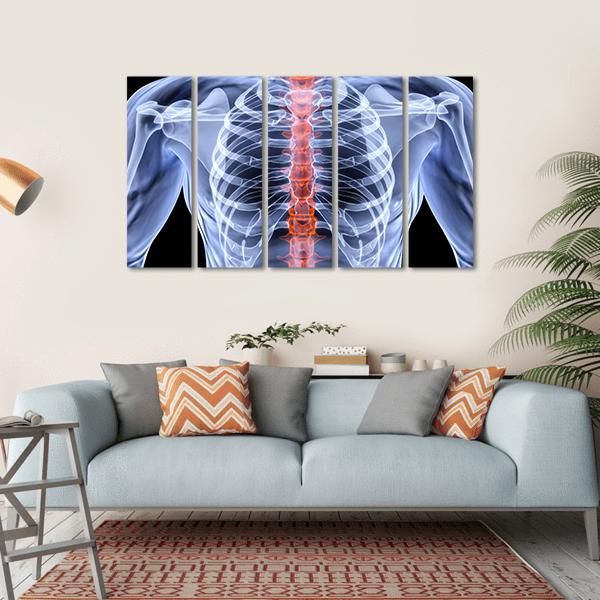 X-Ray Of Men Torso Canvas Wall Art-5 Horizontal-Gallery Wrap-22" x 12"-Tiaracle