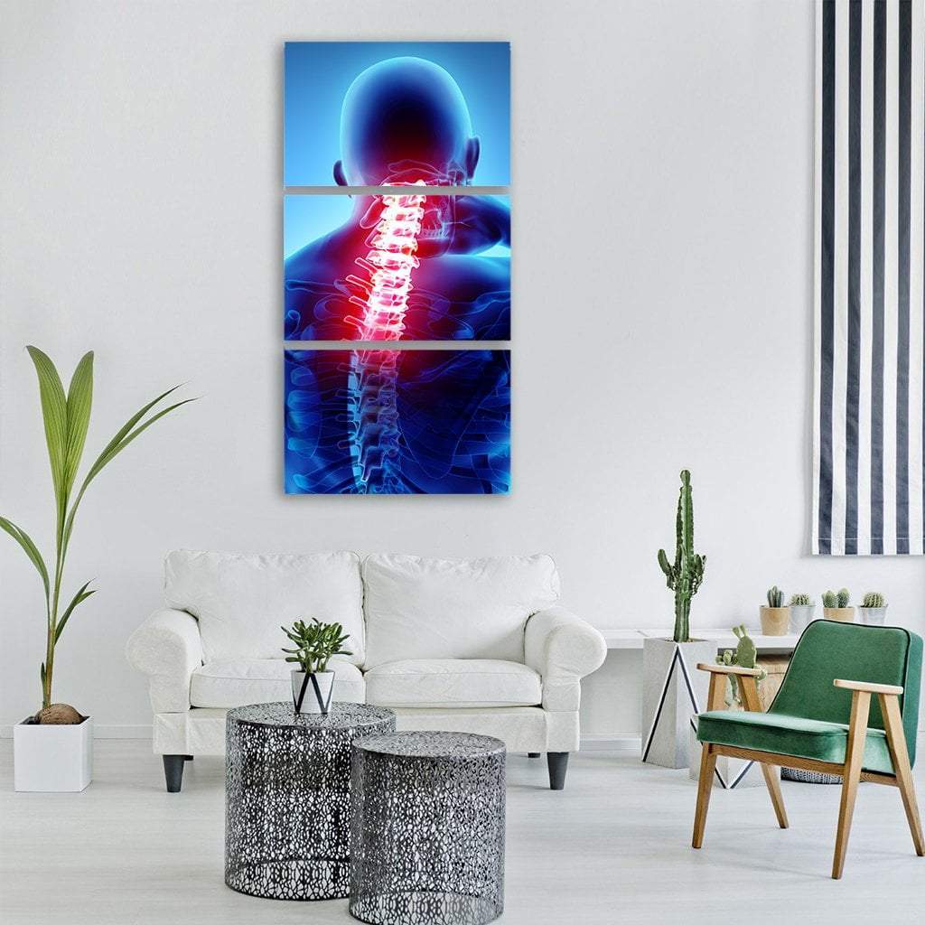 Painful Neck With Cervical Spine Skeleton X-Ray Vertical Canvas Wall Art-3 Vertical-Gallery Wrap-12" x 25"-Tiaracle