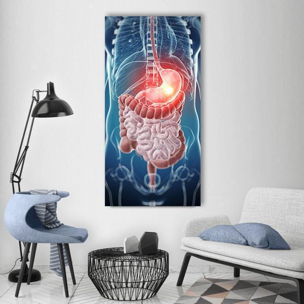 Illustration Of Painful Stomach Vertical Canvas Wall Art-1 Vertical-Gallery Wrap-12" x 24"-Tiaracle
