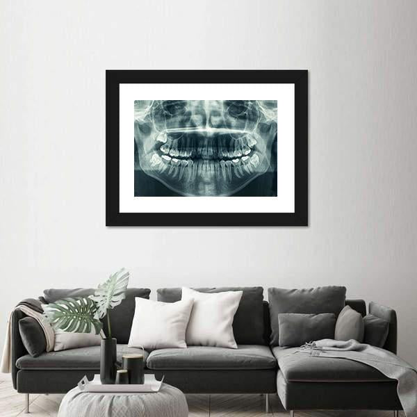 Dental X-Ray Canvas Wall Art-1 Piece-Framed Print-20" x 16"-Tiaracle