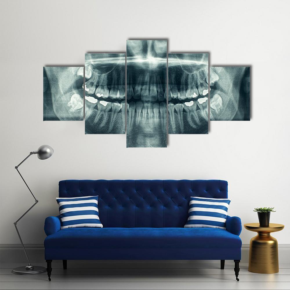 Dental X-Ray Canvas Wall Art-5 Star-Gallery Wrap-62" x 32"-Tiaracle
