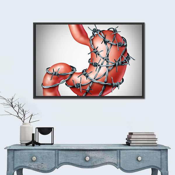 Stomach Pain Canvas Wall Art-1 Piece-Floating Frame-24" x 16"-Tiaracle