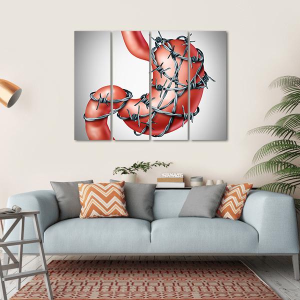 Stomach Pain Canvas Wall Art-4 Horizontal-Gallery Wrap-34" x 24"-Tiaracle