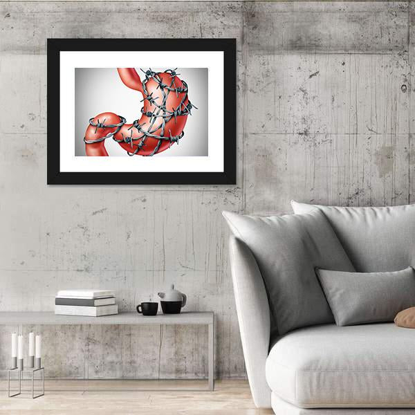Stomach Pain Canvas Wall Art-3 Horizontal-Gallery Wrap-25" x 16"-Tiaracle