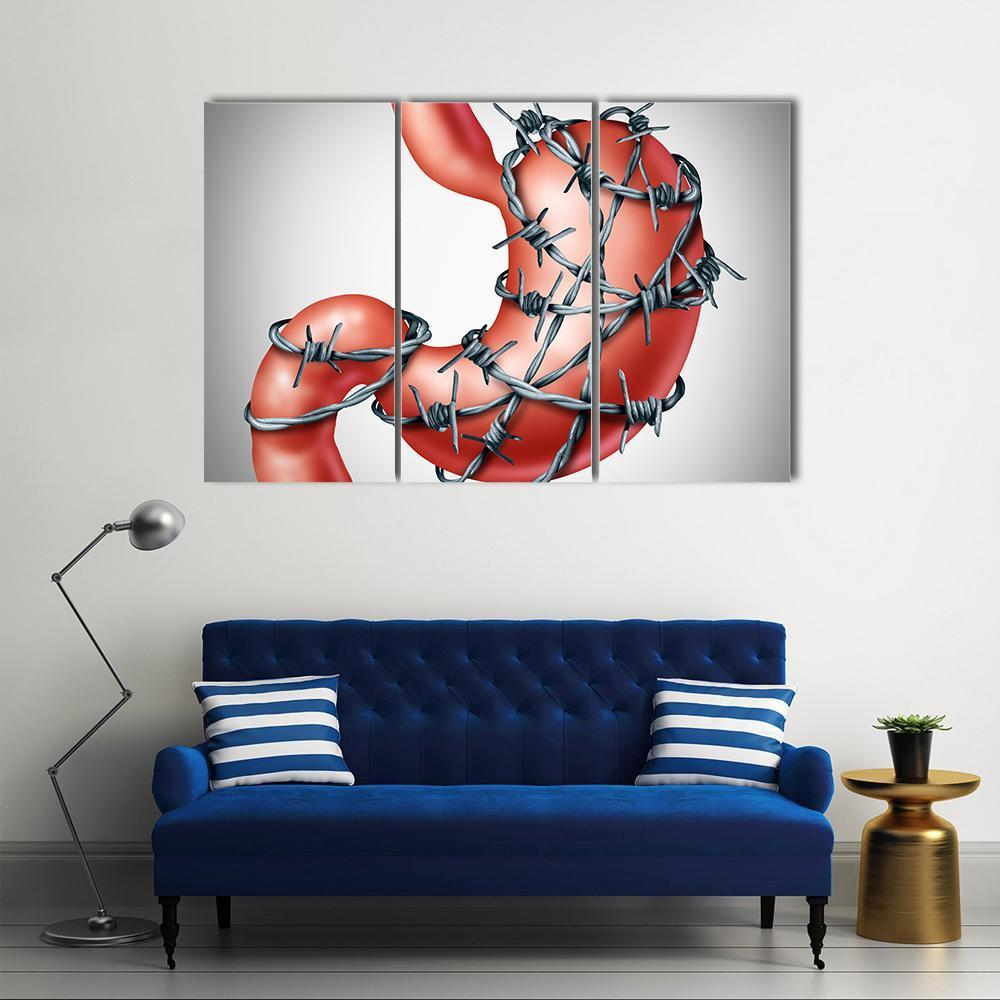 Stomach Pain Canvas Wall Art-3 Horizontal-Gallery Wrap-37" x 24"-Tiaracle