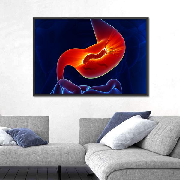 View Of Stomach Canvas Wall Art-5 Horizontal-Gallery Wrap-22" x 12"-Tiaracle