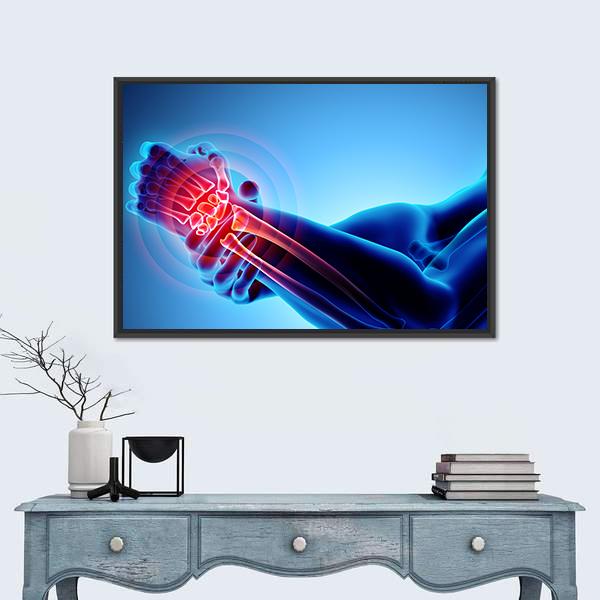 Wrist Painful Skeleton X-Ray Canvas Wall Art-1 Piece-Floating Frame-24" x 16"-Tiaracle