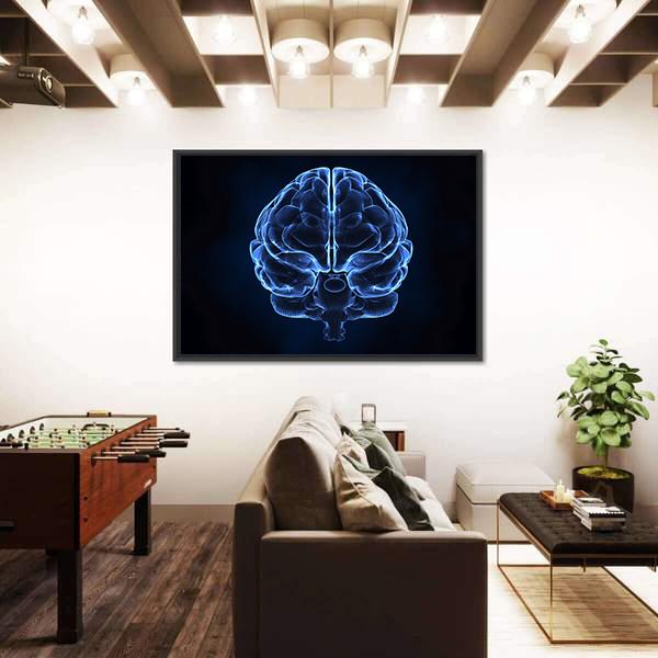 X-Ray Of Human Brain Canvas Wall Art-3 Horizontal-Gallery Wrap-25" x 16"-Tiaracle