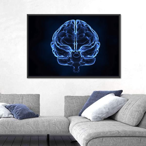 X-Ray Of Human Brain Canvas Wall Art-3 Horizontal-Gallery Wrap-25" x 16"-Tiaracle