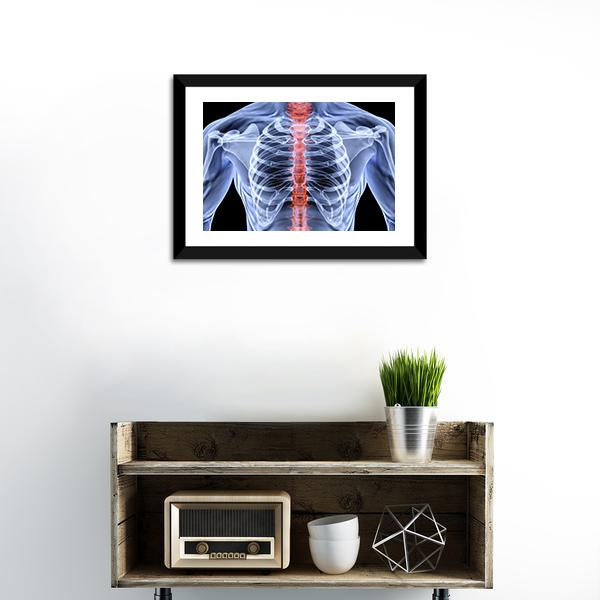 X-Ray Of Men Torso Vertical Canvas Wall Art-3 Vertical-Gallery Wrap-12" x 25"-Tiaracle