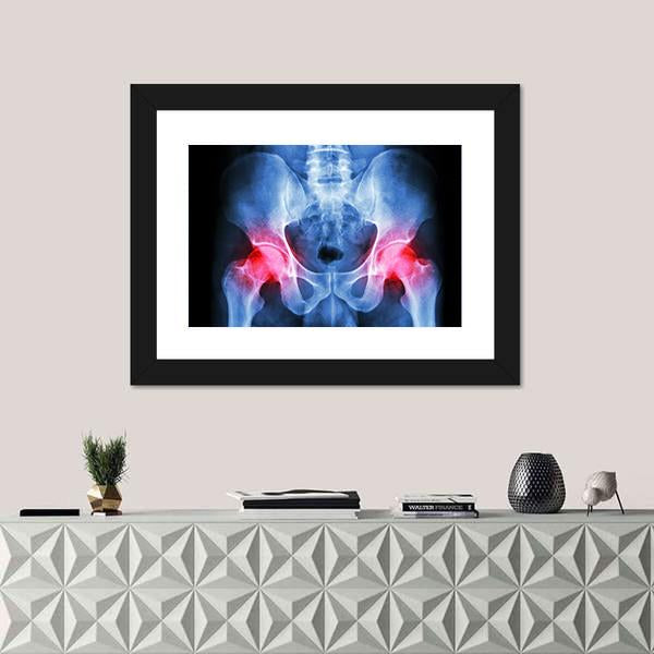 X-Ray Of Pelvis Canvas Wall Art-1 Piece-Framed Print-20" x 16"-Tiaracle
