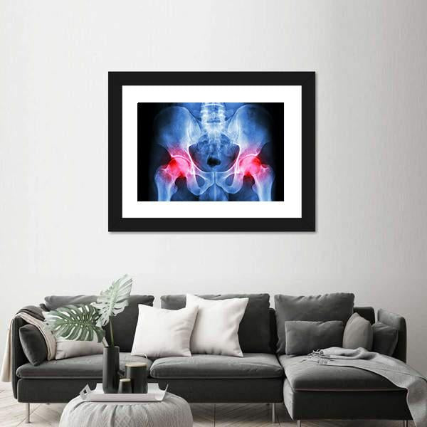 X-Ray Of Pelvis Canvas Wall Art-5 Horizontal-Gallery Wrap-22" x 12"-Tiaracle